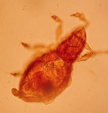 Ambre 3