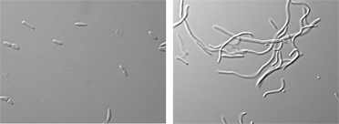 Las células bacterianas