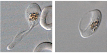 cellules déformées