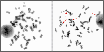 Photo_Chromosome