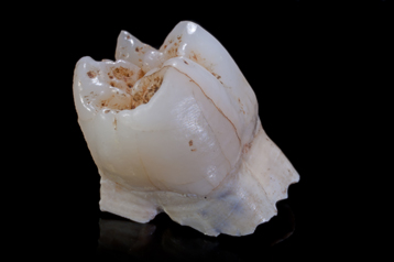 Dents 1