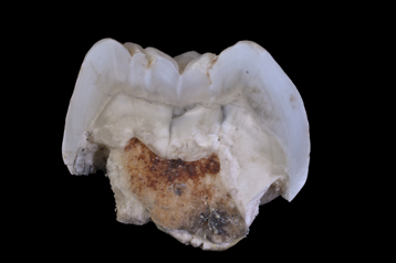 Dents 2