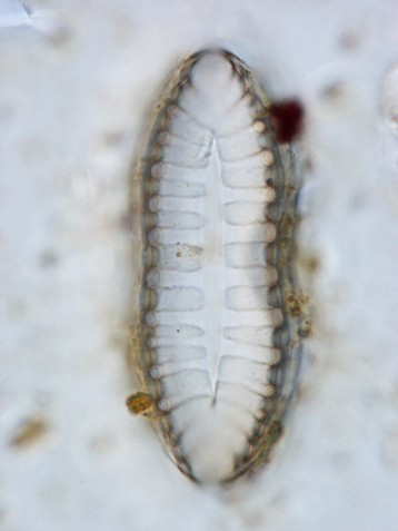 diatomée Surinella