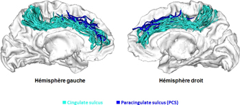 hemispheres 2