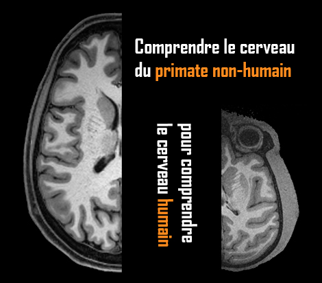 illustration IRM