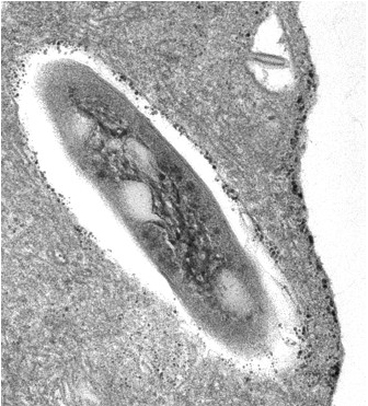 Macrophage _ Neyrolles