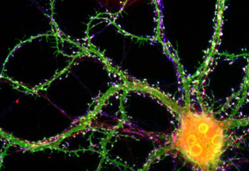 information neuronale 3