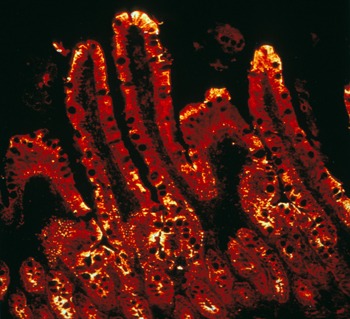 Muqueuse intestinale