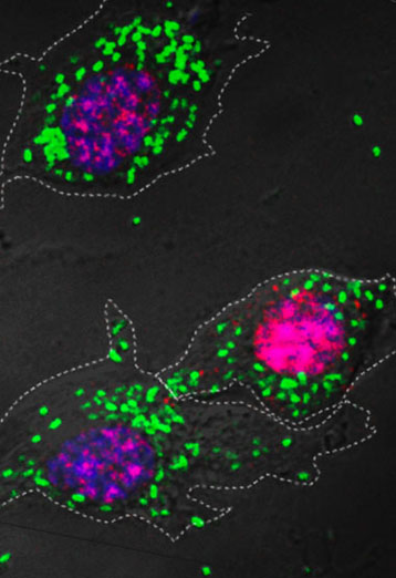 Macrophage 1