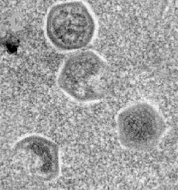 Marseillevirus