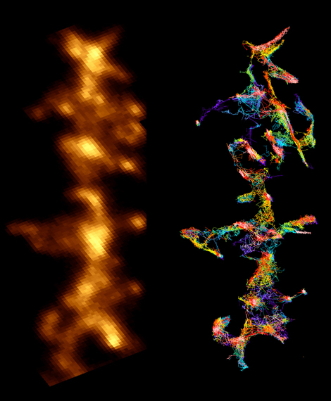 dendrite_neurone