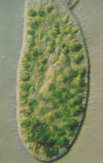 Microphotographie d\'une paramécie en symbiose avec des centaines de cellules de chlorelles (ronds verts).