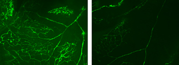 Photo_Biotherapie