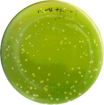 « Gazon » de l\'algue Chlorelle sur une boite de Pétri, montrant des petites « plaques » circulaires (petits cercles décolorés) révélatrice de la présence d\'un virus.