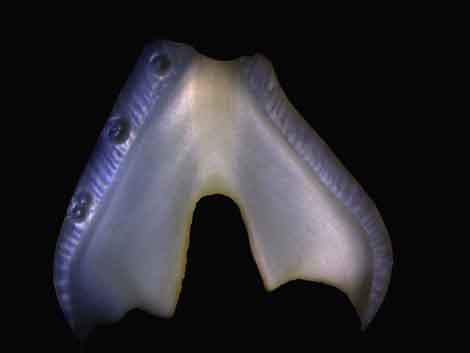 Tooth 1