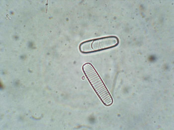 diatoms