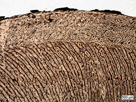 Bone histo
