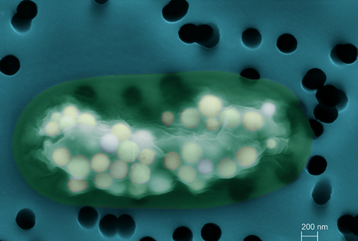 Image of Candidatus Gloeomargarita lithophora