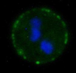P. falciparum parasitized erythrocytes. The var2CSA protein is colored green.