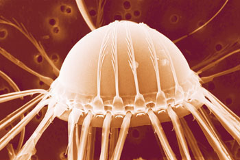 diatom