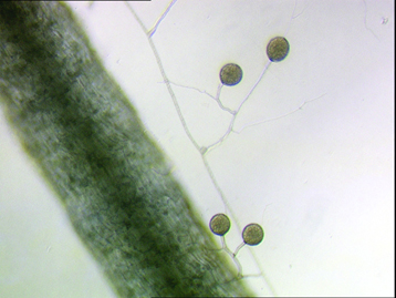 Las esporas de Glomus intraradices