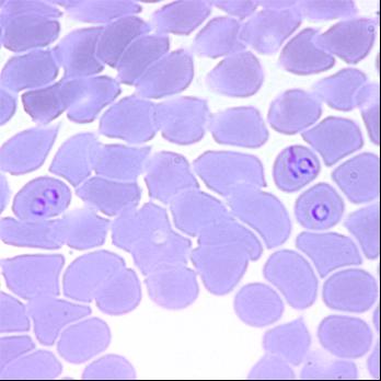 Plasmodium Falciparum Images