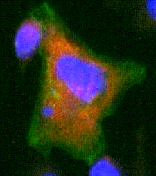 hormones cancer du sein 2
