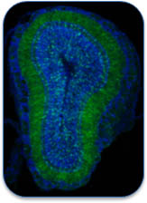 Section of a mouse brain observed using a fluorescence microscope