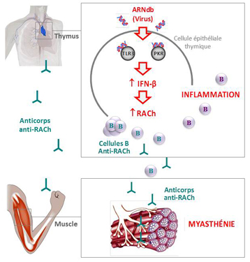 MaladieAutoImmune