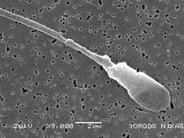 Un espermatozoide control de verse con un microscopio electrónico de barrido
