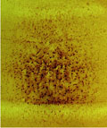 Dossier Neuro-astrocytes