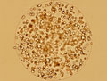 cellules foie
