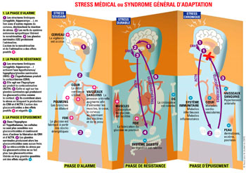 manifestation du stress sur le corps manifestation du stress sur le corps